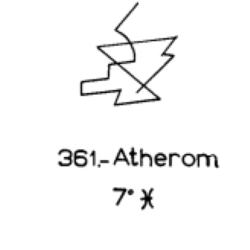  361: Atherom 